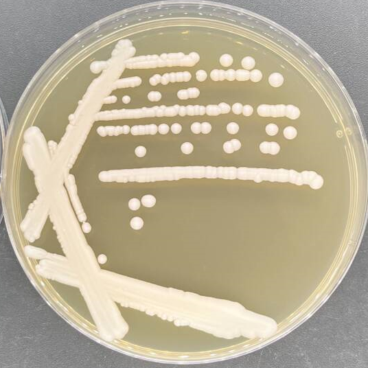 Cryptococcus magnus-伟业计量