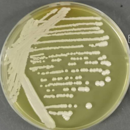 Candida boleticola					-伟业计量