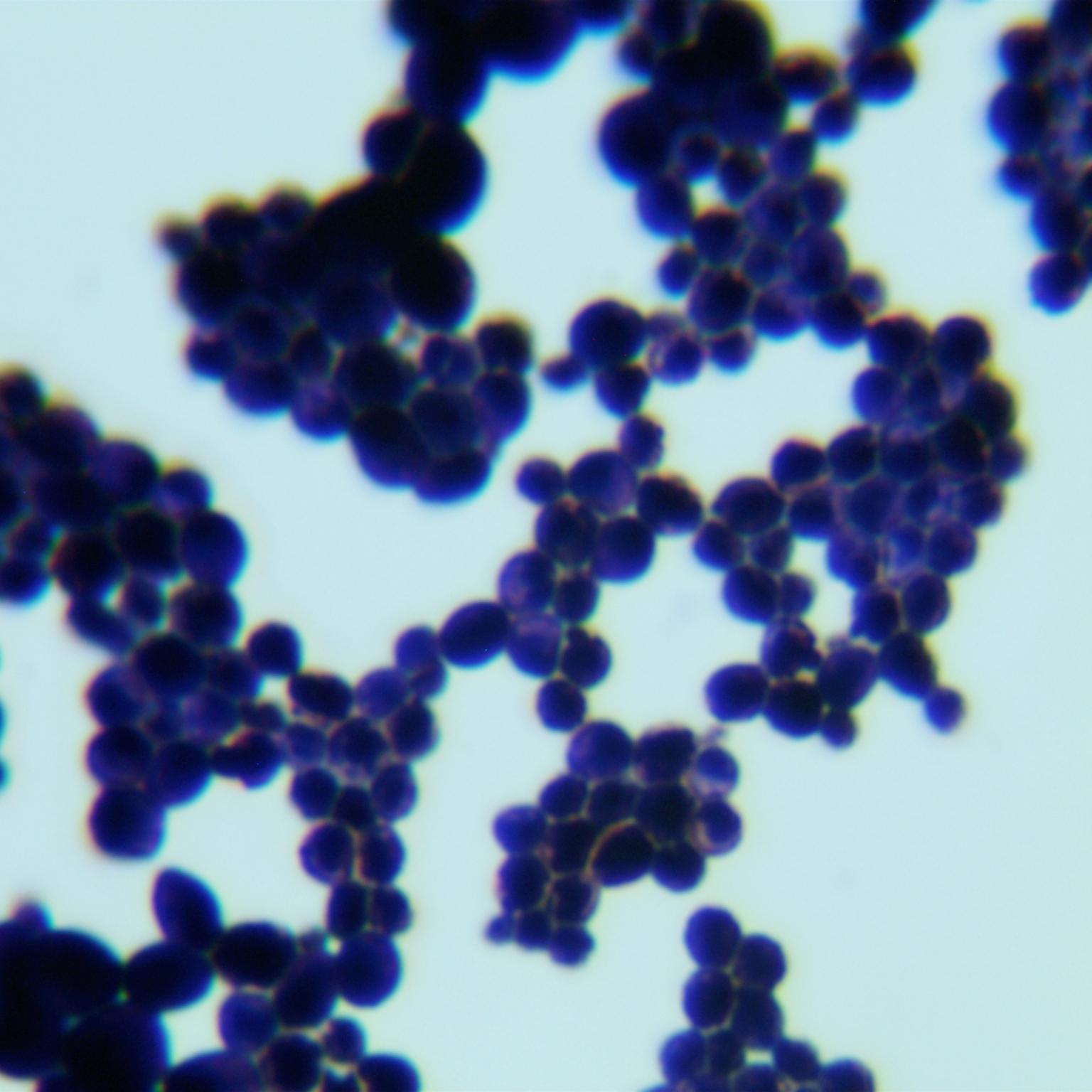 Candida parablackwelliae				-伟业计量