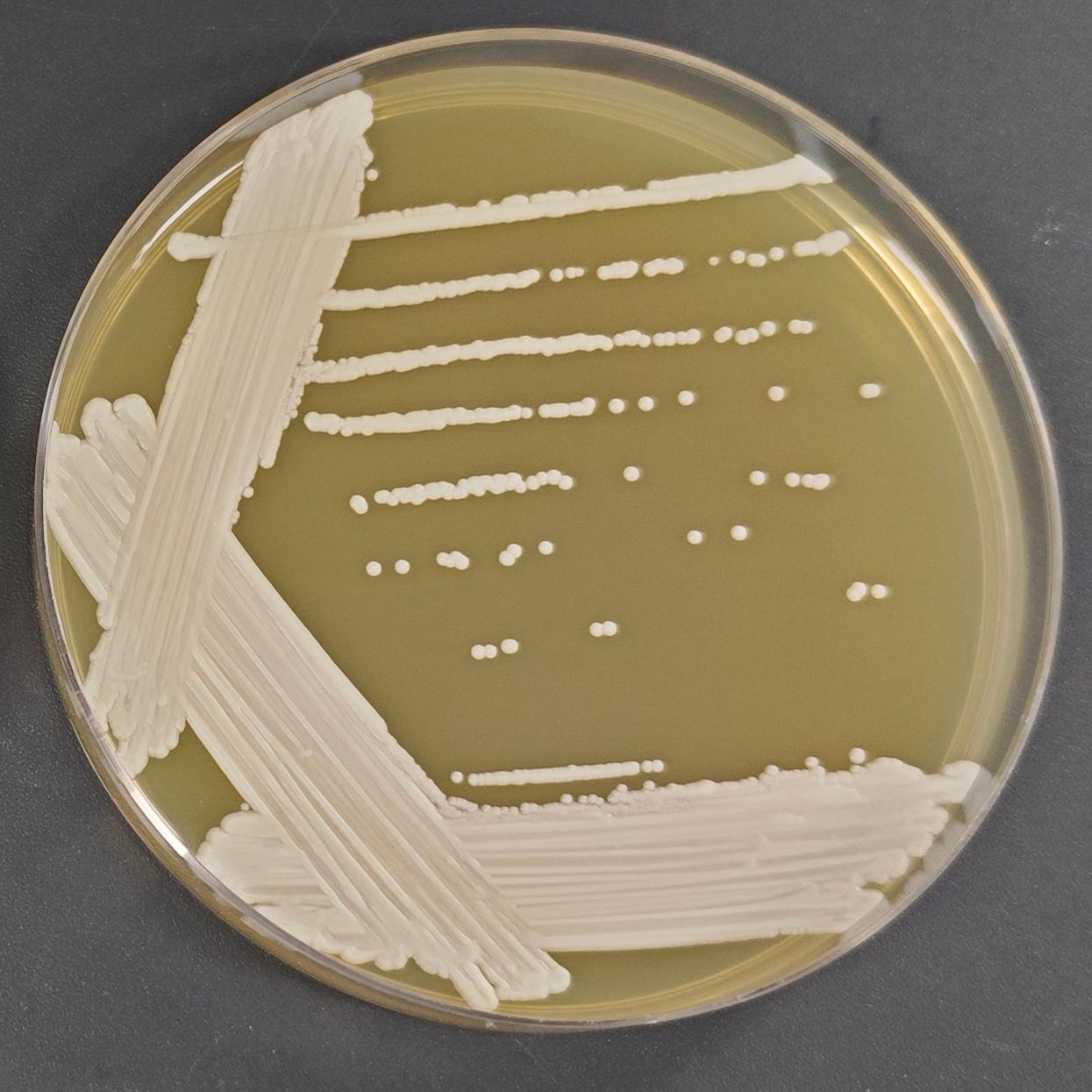 Candida parablackwelliae				-伟业计量
