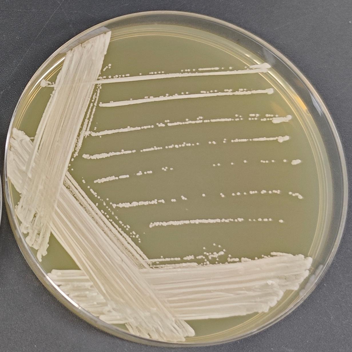 Sungouiella intermedia						-伟业计量