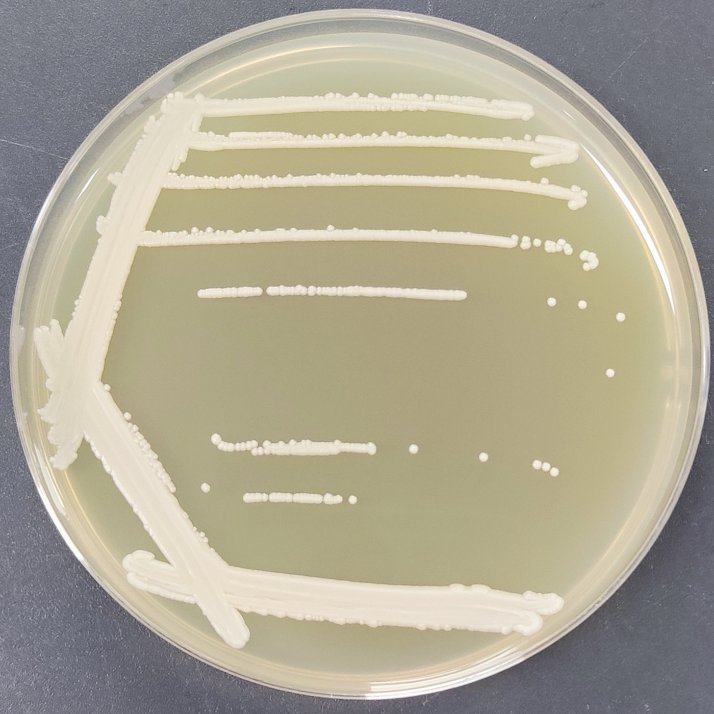 Candida railenensis											-伟业计量
