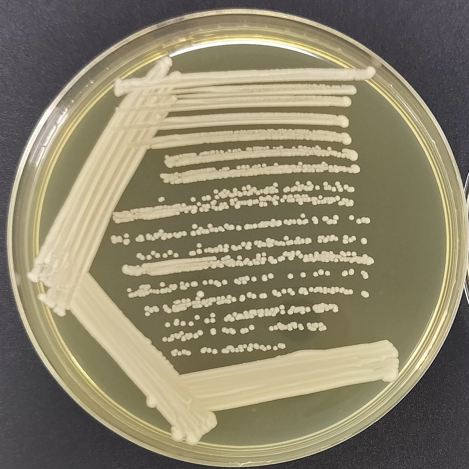 Scheffersomyces stipitis-伟业计量