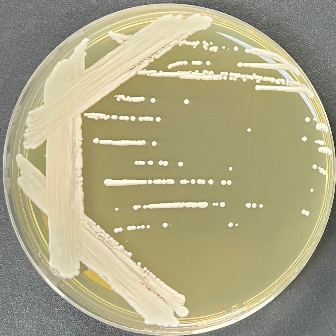 Cyberlindnera saturnus-伟业计量