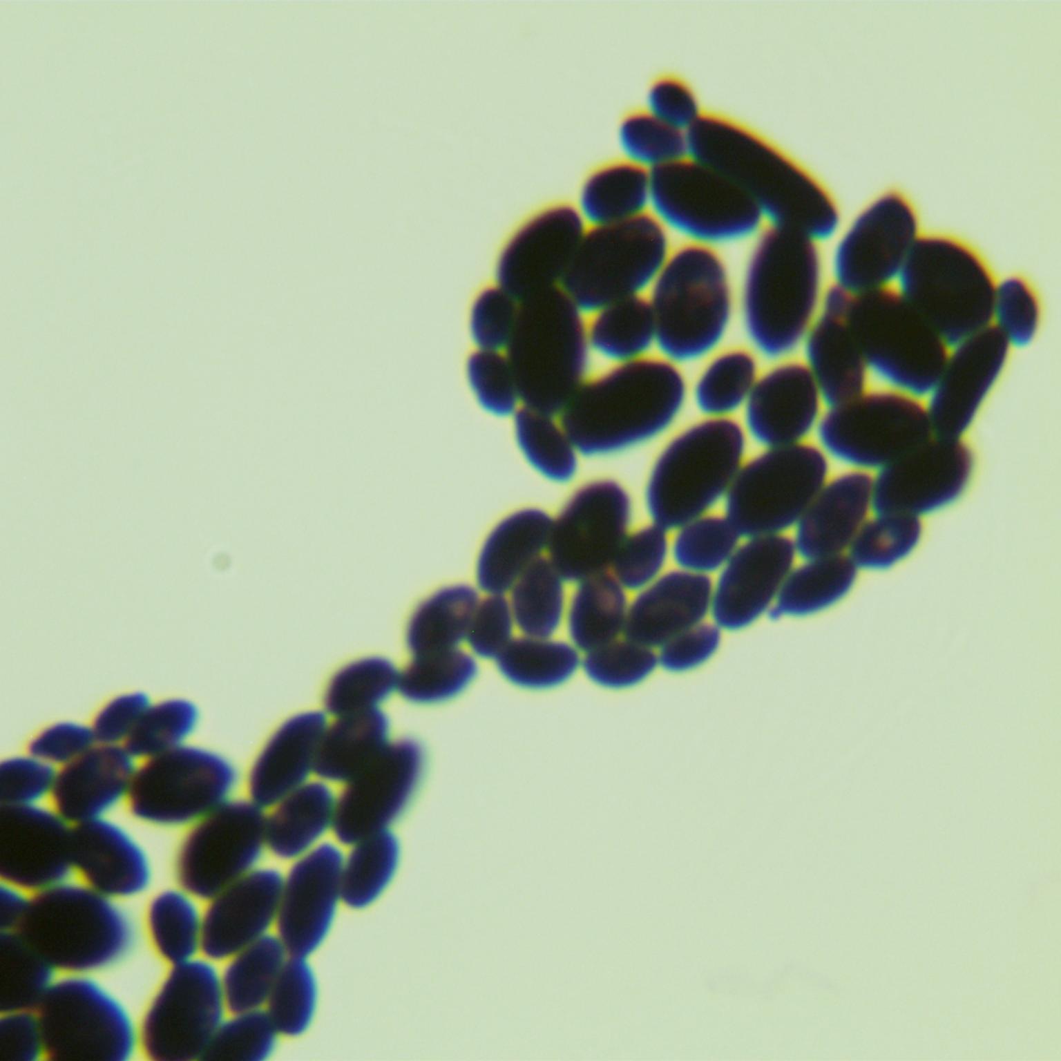 Cyberlindnera saturnus-伟业计量